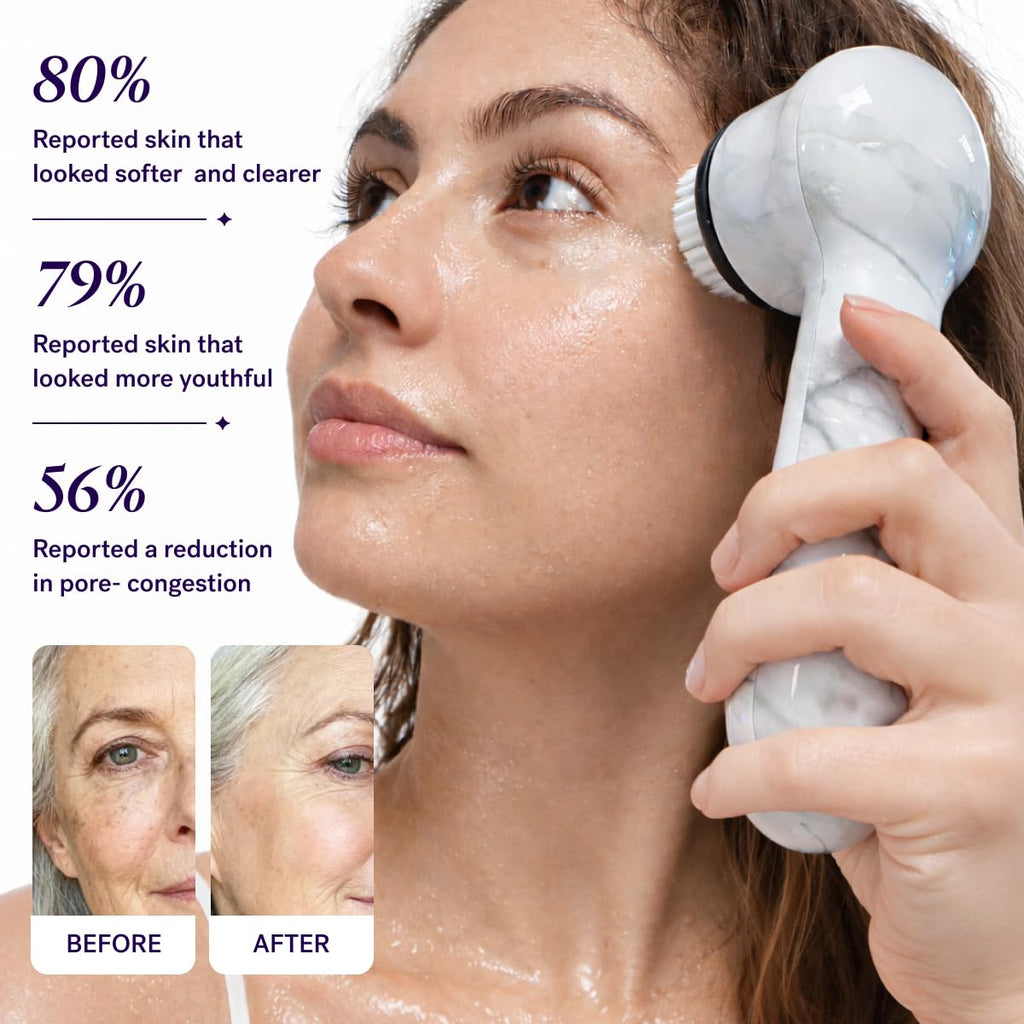 Beauty Soniclear Allure 2026 Readers Choice Winner Sonic (No Rotating) Facial Cleansing + Exfoliation Brush for Men/Women, Antimicrobial Protected Bristles, 4 Speeds, Serum Infusion Head